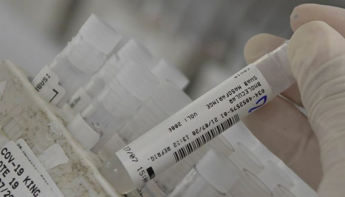 An employee at the Hermes Pardini laboratory shows a sample of the coronavirus disease (COVID-19) testing with PCR amplification, in Vespasiano, near Belo Horizonte, Brazil, July 23, 2020. Picture taken July 23, 2020. REUTERS/Washington Alves