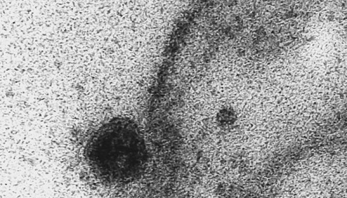 Início do processo de infecção pelo patógeno. Registro do momento exato em que uma célula é infectada pelo novo coronavírus, obtido durante estudo que investiga a replicação viral do Sars-CoV-2 realizado pelos Laboratório de Morfologia e Morfogênese Viral e Laboratório de Vírus Respiratórios e do Sarampo, Instituto Oswaldo Cruz.