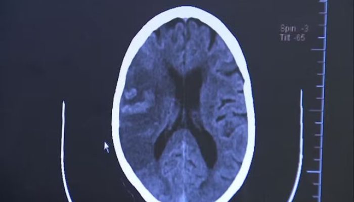 zxccad Foto: Reprodução